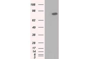 HEK293T cells were transfected with the pCMV6-ENTRY control (Left lane) or pCMV6-ENTRY USP5 (Right lane) cDNA for 48 hrs and lysed. (USP5 anticorps)
