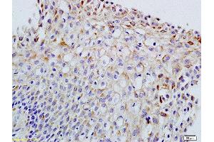 Formalin-fixed and paraffin embedded rat ovary labeled with Anti-FSH/FSHB Polyclonal Antibody, Unconjugated  at 1:200 followed by conjugation to the secondary antibody and DAB staining (FSHB anticorps  (AA 61-98))
