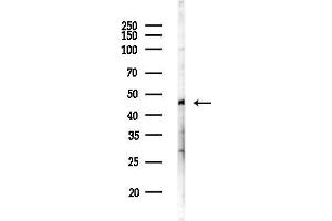 anti-Zinc Finger Protein 524 (ZNF524) antibody