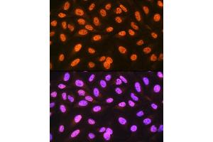 Immunofluorescence analysis of U-2 OS cells using hnRNP C Rabbit mAb (ABIN7267629) at dilution of 1:100 (40x lens). (HNRNPC anticorps)