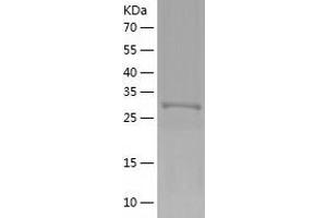 Western Blotting (WB) image for Nicotinamide Nucleotide Adenylyltransferase 1 (NMNAT1) (AA 1-285) protein (His tag) (ABIN7124172)
