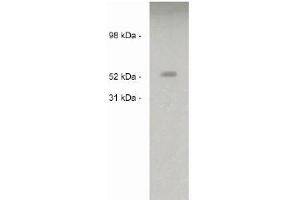 Image no. 1 for anti-Sulfatase 2 (SULF2) antibody (ABIN265173) (SULF2 anticorps)