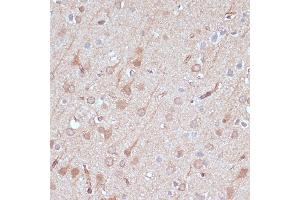 Immunohistochemistry of paraffin-embedded rat brain using  antibody (ABIN7265470) at dilution of 1:100 (40x lens).
