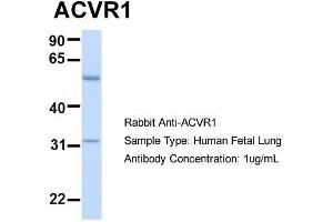 Host:  Rabbit  Target Name:  ACVR1  Sample Type:  Human Fetal Lung  Antibody Dilution:  1. (ACVR1 anticorps  (N-Term))