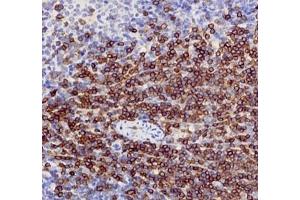 Immunohistochemistry of paraffin embedded mouse spleen using CD3 (ABIN7073386) at dilution of 1: 1000 (400x lens)