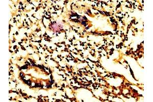 IHC image of ABIN7146960 diluted at 1:200 and staining in paraffin-embedded human appendix tissue performed on a Leica BondTM system.