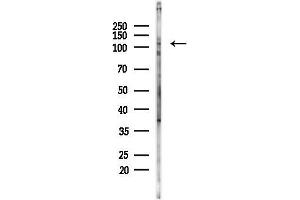 Western blot analysis of lysates from Mouse liver, using GABBR1 Antibody at 1/1000 dilution.
