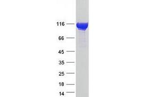 Validation with Western Blot
