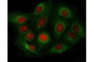 IF analysis of Angiogenin/ANG using anti-Angiogenin/ANG antibody (ABIN4886457) and anti-Beta Tubulin antibody (ABIN7602743). (ANG anticorps  (AA 25-147))