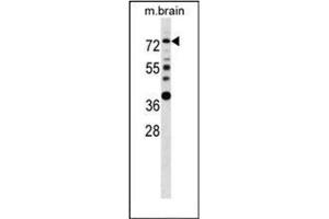 Western blot analysis of Estrogen receptor alpha  Antibody  in mouse brain tissue lysates (35ug/lane). (Estrogen Receptor alpha anticorps  (AA 53-301))