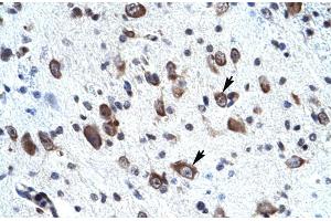 Rabbit Anti-MORF4L2 Antibody ,Paraffin Embedded Tissue: Human neural cell  Cellular Data: Epithelial cells of renal tubule  Antibody Concentration: 4. (MORF4L2 anticorps  (N-Term))