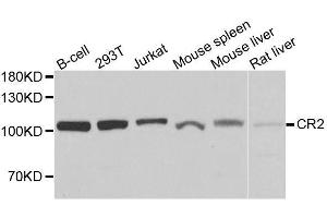 Western blot analysis of extracts of various cell lines, using CR2 antibody. (CD21 anticorps  (AA 300-590))