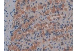 Detection of FABP9 in Rat Stomach Tissue using Polyclonal Antibody to Fatty Acid Binding Protein 9, Testis (FABP9) (FABP9 anticorps  (AA 1-130))