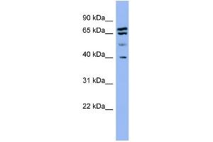 WB Suggested Anti-SH3GL2  Antibody Titration: 0. (SH3G2 anticorps  (Middle Region))