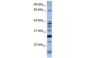 WB Suggested Anti-DOLPP1 Antibody Titration:  0. (DOLPP1 anticorps  (N-Term))