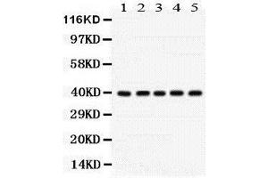 Western Blotting (WB) image for anti-Cyclin-Dependent Kinase 7 (CDK7) (AA 31-346) antibody (ABIN3042742) (CDK7 anticorps  (AA 31-346))