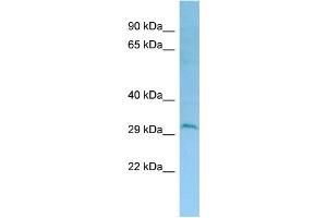 WB Suggested Anti-DERL2 Antibody Titration: 1. (Der1-Like Domain Family, Member 2 (DERL2) (C-Term) anticorps)