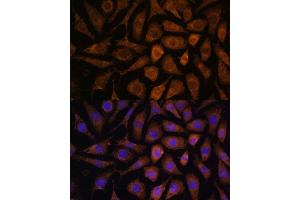 Immunofluorescence analysis of L929 cells using M Polyclonal Antibody (ABIN7268628) at dilution of 1:100 (40x lens).