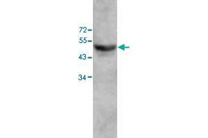 Western blot analysis of human fetal colon lysate with ZC3H10 polyclonal antibody  at 1 : 500 dilution. (ZC3H10 anticorps  (AA 136-412))