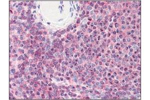 Immunohistochemistry (IHC) image for anti-Cofilin 1 (CFL1) (AA 1-166), (N-Term) antibody (ABIN336102) (Cofilin anticorps  (N-Term))