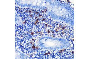 Immunohistochemistry of paraffin-embedded human appendix using S100B Rabbit mAb (ABIN7270131) at dilution of 1:100 (40x lens).