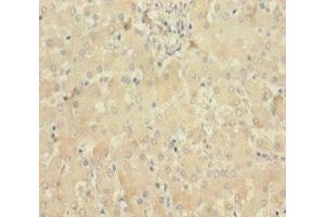 Immunohistochemistry of paraffin-embedded human liver tissue using ABIN7160100 at dilution of 1:100 (MLKL anticorps  (AA 1-471))