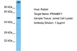 Host: Rabbit Target Name: PRAMEF1 Sample Type: Jurkat Whole Cell lysates Antibody Dilution: 1. (PRAMEF1 anticorps  (N-Term))