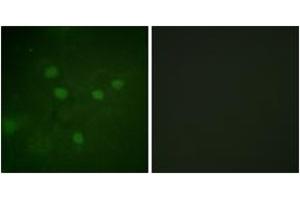 Immunofluorescence analysis of COS7 cells, using NFAT5 (Phospho-Ser1197) Antibody. (NFAT5 anticorps  (pSer1197))