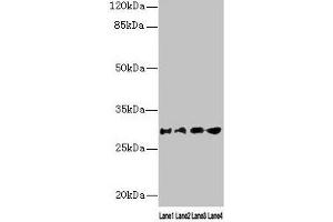 Western blot All lanes: AQP1 antibody at 16 μg/mL Lane 1: Rat heart tissue Lane 2: Mouse skeletal muscle tissue Lane 3: A549 whole cell lysate Lane 4: 293T whole cell lysate Secondary Goat polyclonal to rabbit IgG at 1/10000 dilution Predicted band size: 29, 20, 24, 17 kDa Observed band size: 29 kDa (Aquaporin 1 anticorps  (AA 220-269))