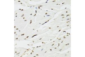 Immunohistochemistry of paraffin-embedded mouse heart using EDF1 antibody (ABIN5971272) at dilution of 1/100 (40x lens). (EDF1 anticorps)