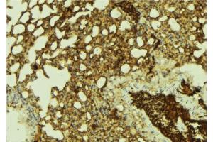 ABIN6269406 at 1/100 staining Mouse lung tissue by IHC-P.