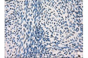 Immunohistochemical staining of paraffin-embedded endometrium tissue using anti-FRKmouse monoclonal antibody. (FRK anticorps)