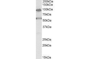 ABIN2560309 (0. (TBC1D9 anticorps  (Internal Region))