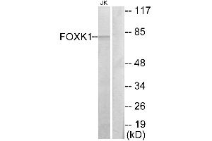 Western blot analysis of extracts from Jurkat cells, using FOXK1 antibody. (Foxk1 anticorps  (C-Term))