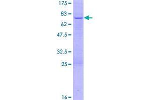 Image no. 1 for serpin Peptidase Inhibitor, Clade E (Nexin, Plasminogen Activator Inhibitor Type 1), Member 2 (SERPINE2) (AA 1-398) protein (GST tag) (ABIN1319640)