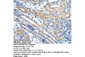 Rabbit Anti-RPUSD2 Antibody  Paraffin Embedded Tissue: Human Kidney Cellular Data: Epithelial cells of renal tubule Antibody Concentration: 4. (RPUSD2 anticorps  (N-Term))
