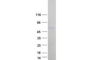 Validation with Western Blot