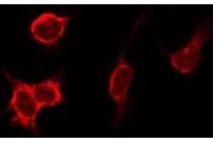 ABIN6275888 staining HeLa by IF/ICC. (Cathepsin D anticorps  (C-Term))