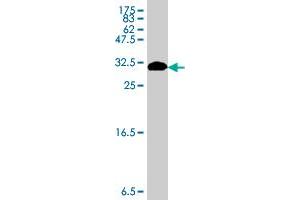 Western Blot detection against Immunogen (31.