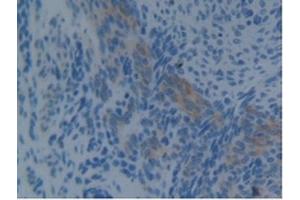 Detection of PDCD6IP in Mouse Uterus Tissue using Polyclonal Antibody to Programmed Cell Death Protein 6 Interacting Protein (PDCD6IP) (ALIX anticorps  (AA 1-239))