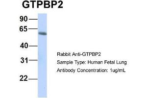 Host:  Rabbit  Target Name:  GTPBP2  Sample Type:  Human Fetal Lung  Antibody Dilution:  1. (GTPBP2 anticorps  (N-Term))
