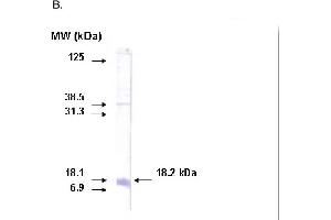 Western blot on recombinant protein corresponding to C-terminal region of CYP26A1 protein using CYP26A1 antibody.