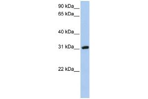 WB Suggested Anti-DKKL1 Antibody Titration: 0. (DKK1 anticorps  (C-Term))