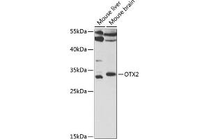 Western blot analysis of extracts of various cell lines, using OTX2 antibody (ABIN6131791, ABIN6145091, ABIN6145093 and ABIN6221138) at 1:1000 dilution. (OTX2 anticorps  (AA 140-280))
