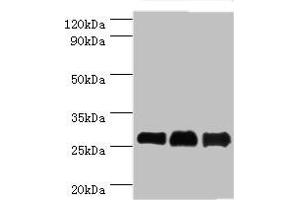 Western blot All lanes: B-cell lymphoma/leukemia 10 antibody at 9 μg/mL Lane 1: Mouse gonad tissue Lane 2: MCF-7 whole cell lysate Lane 3: NIH/3T3 whole cell lysate Secondary Goat polyclonal to rabbit IgG at 1/10000 dilution Predicted band size: 26 kDa Observed band size: 26 kDa (Cyclin D1 anticorps  (AA 1-233))