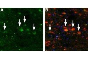 Expression of Mucolipin 3 in mouse brain stem - Immunohistochemical staining of TRPML3 in mouse brain stem using Anti-TRPML3 (Mucolipin 3) Antibody (ABIN7043338 and ABIN7044043).