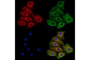 ABIN7094729 and ABIN7098780 staining HepG2 cells by IF/ICC. (STS anticorps  (C-Term))