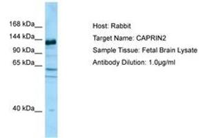 Image no. 1 for anti-Caprin Family Member 2 (CAPRIN2) (AA 924-973) antibody (ABIN6750090) (CAPRIN2 anticorps  (AA 924-973))