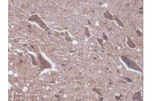 DAB staining on IHC-P; Samples: Rat Spinal cord Tissue