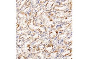 Immunohistochemistry of paraffin embedded rat kidney using Clcn5 (ABIN7073471) at dilution of 1:200 (400x lens) (Chloride Channel 5 anticorps)